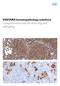 VENTANA hematopathology solutions Comprehensive aids for detecting and subtyping