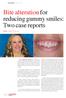 Bite alteration for reducing gummy smiles: Two case reports