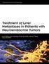 Treatment of Liver Metastases in Patients with Neuroendocrine Tumors