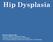 Hip Dysplasia David S. Feldman, MD