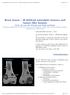 The Radiology Assistant : Bone tumor - ill defined osteolytic tumors and tumor-like lesions