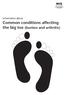 Information about. Common conditions affecting the big toe (bunion and arthritis)