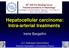 Hepatocellular carcinoma: Intra-arterial treatments