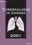 Tuberculosis in Canada