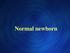 TERMS: Neonatal Period: Birth --> 28 days of life. Term Infant: weeks of gestation