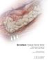 DermaSpan Acellular Dermal Matrix. Reinforcement of Ruptured Posterior Tibial Tendon Repair. Surgical Protocol by Charles Zelen, DPM, FACFAS