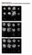 Dynamics of mono, di and tri-methylated histone H3 lysine 4 during male meiotic prophase I. Nuclei were co-stained for H3.1/H3.2. Progressing stages