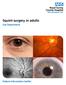 Squint surgery in adults