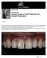 Shadeguides Ceramic Veneers: Tooth Preparation for Enamel Preservation