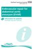 Endovascular repair for abdominal aortic aneurysm (EVAR) Information for patients Sheffield Vascular Institute