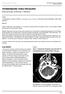 ISPUB.COM. Vertebrobasilar Artery Dissection. A Mohammadi, M Ahmad, D Wolfson CASE REPORT