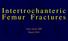 Intertrochanteric Femur Fractures. Alan Afsari, MD March 2014