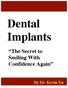 Dental Implants. The Secret to Smiling With Confidence Again. By Dr. Kevin Xu