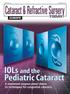 IOLs and the Pediatric Cataract A renowned surgeon panel shares its techniques for congenital cataracts.