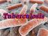 MYCOBACTERIUM. Mycobacterium Tuberculosis (Mtb) nontuberculous mycobacteria (NTM) Mycobacterium lepray