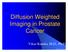 Diffusion Weighted Imaging in Prostate Cancer