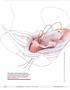 Step by step High uterosacral vaginal vault suspension to repair enterocele and apical prolapse