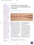 Topical Silicone Sheet Application in the Treatment of Hypertrophic Scars and Keloids