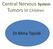 Central Nervous System Tumors in Children. Dr.Mina Tajvidi