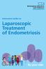 Information leaflet on. Laparoscopic Treatment of Endometriosis