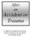After an Accident or Trauma. A leaflet for patients who have been involved in an accident or traumatic event.