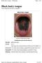 Black hairy tongue. Black hairy tongue.   From Wikipedia, the free encyclopedia