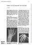 Surgery for the rheumatoid wrist and hand
