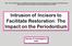 Intrusion of Incisors to Facilitate Restoration: The Impact on the Periodontium