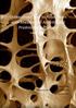 Osteoporosis and its Association with Rheumatoid Arthritis and Prednisolone Therapy