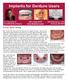 Implants for Denture Users
