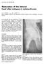 Restoration of the femoral head after collapse in osteoarthrosis