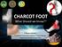 CHARCOT FOOT. What Should we Know?? I Wayan Subawa. Orthopaedi & Traumatology Subdivision Udayana University Sanglah General Hospital, Denpasar-Bali
