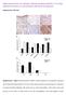 High expression of cellular retinol binding protein-1 in lung adenocarcinoma is associated with poor prognosis