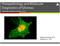 Histopathology and Molecular Diagnostics of Gliomas