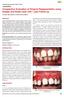 Comparative Evaluation of Gingival Depigmentation using Scalpel and Diode Laser with 1 year Follow-up