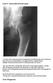 Case 4 Generalised bone pain
