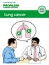 Lung cancer. easy read
