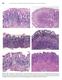 594 Lewin, Weinstein, and Riddell s Gastrointestinal Pathology and Its Clinical Implications