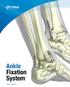 Ankle Fixation System. System Brochure