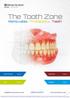 The Tooth Zone Removable Prothestics Teeth Ivoclar Vivadent Page 2-3 Masterdent Page 4 Kulzer Page 5-6 Degudent Page