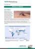 Advisory on Malaria. What is Malaria? 21 November Malaria is a serious, lifethreatening