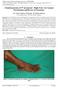 Chondrosarcoma of 5 th metatarsal Right Foot: An Unusual Presentation and Review of Literature